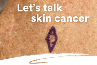 Melanoma Awareness Month Could Save Your Life